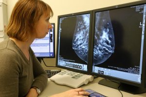 Women’s knowledge about breast density is still patchy: new research